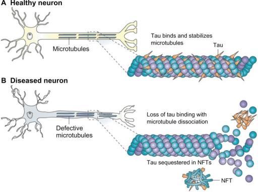 fibers found in neural cytoplasm Tau