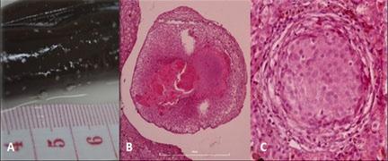 68 Samaniego et al. Macroscopic and microscopic findings in the organs of pythons with pneumonia 69 Figure 1: Liver.
