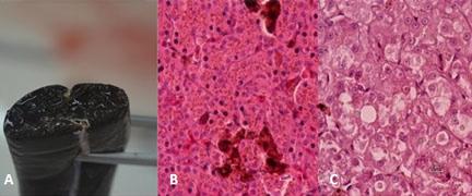 Microscopically, there were random multifocal areas of granuloma formation that can be chronic (B) or histiocytic (C) in nature.