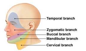 CN VII: Facial Nerve Originates in the pons 5 Branches 1. Temporal 2. Zygomatic 3. Buccal 4. Mandibular 5.