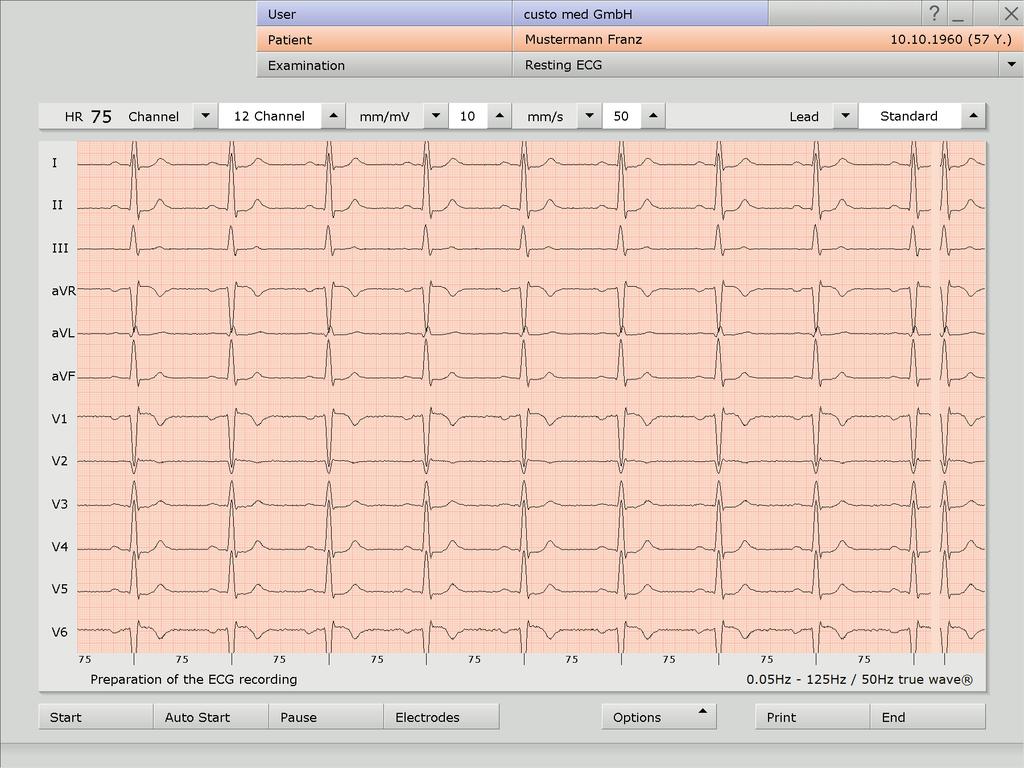 The preset standard procedures for automatic ECG and manual recordings are described here.