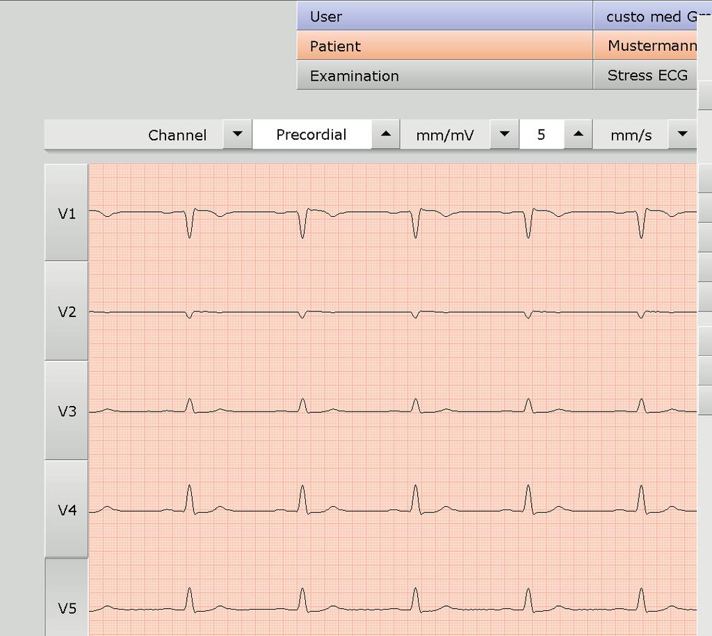 If several ECG devices are connected to the workplace, the Select ECG Device dialogue will be displayed.