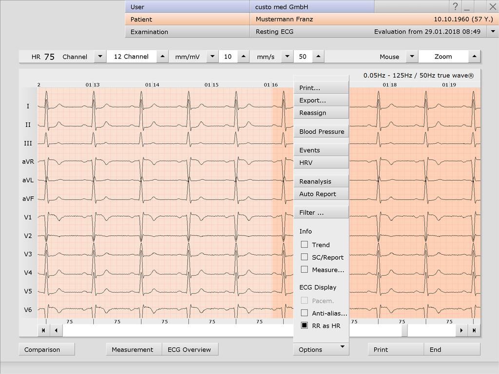 Resting ECG evaluation, Options menu 3) Print menu for temporary changes to the print settings Button for exporting the evaluation (e.g. as Excel, PDF, DICOM.