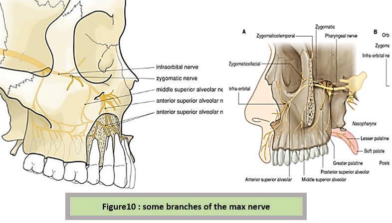 ganglion. 3- Zygomatic nerve, at the inferior orbital fissure. the zygomatic nerve divides into zygomaticotemporal and zygomaticofacial rem.