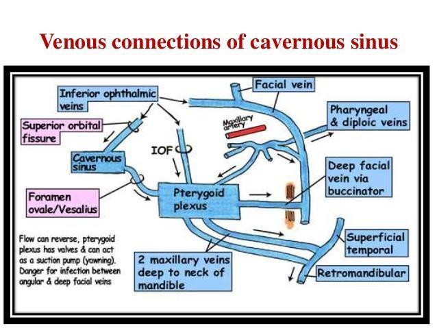 Dangerous area of the face: Emissary veins connect the pterygoid plexus of veins with the cavernous sinus (through foramen ovale) >> if there s an Infection pus around the nose, it can
