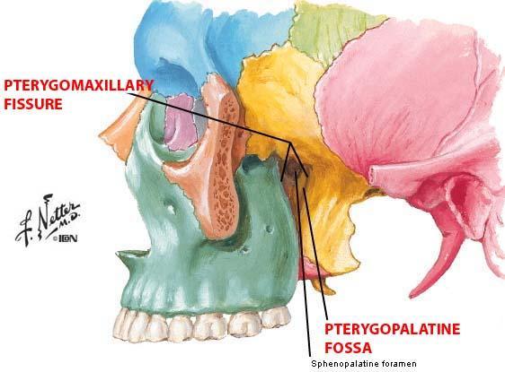 Pterygomaxillary fissure is a vertical fissure between the pterygoid
