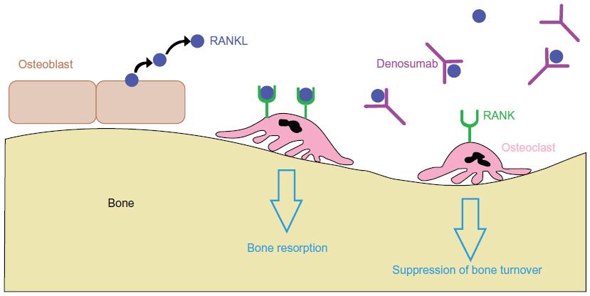 Bone Remodeling Osteoblasts and osteoclasts are