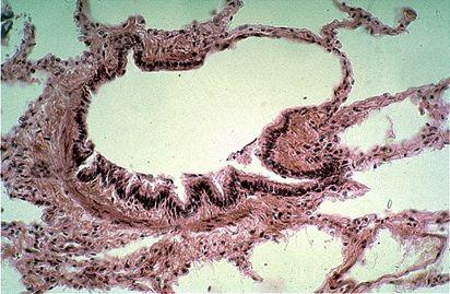 cuboidal partially ciliated epithelium With Clara cells (With NO