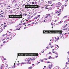 PULMONARY ALVEOLI Alveolar phagocytes (Lung macrophages) (Dust Cells) Sites: In the lumen of pulmonary