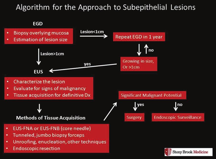 L Menon and JM Buscaglia Figure 5. Algorithm for the approach to subepithelial lesions (adapted from Humphris and Jones, 2008).