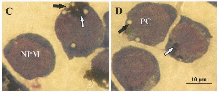 Impairment of alveolar macrophage phagocytosis by particles White arrows 250 nm CB particles Black arrows