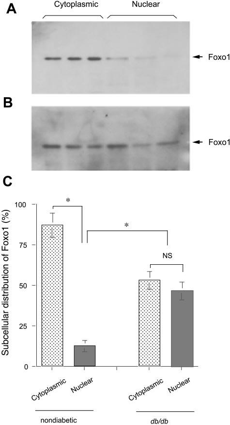 Aliquots (20 g) of cytoplasmic and nuclear protein lysates from nondiabetic (A) and diabetic livers (B) were subjected to Western blot analysis using anti-foxo1 antibody.