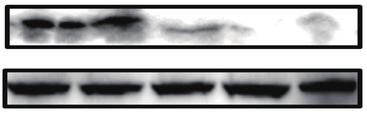 () nalysis of the amount of cleaved Caspase-3 or PRP1, and phosphorylation level of p53 by western blot.