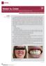 Veneer vs. Crown. cosmetic townie clinical. JANUARY 2012» dentaltown.com