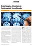 Brain Imaging Alterations in Posttraumatic Stress Disorder