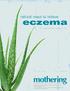 eczema natural ways to relieve