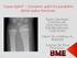 Super Splint Dynamic splint for pediatric distal radius fractures
