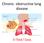 Chronic obstructive lung disease. Dr/Rehab F.Gwada