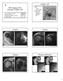 Rotator cuff. MR Imaging of the Shoulder: Rotator Cuff. Trauma. Trauma. Trauma. Tendon calcification. Acute. Degenerative. Trauma Calcific tendinitis