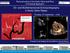 3D- and Multidimensional Echocardiography in Aortic Valve Repair