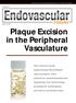 Plaque Excision in the Peripheral Vasculature