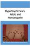 Hypertrophic Scars, Keloid and Homoeopathy