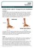Achilles tendon rupture: management and rehabilitation