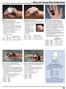 Hand and Finger Splints/Orthoses