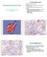 Alveolar Histiocytosis. Non-infectious conditions of Rats. Alveolar Histiocytosis
