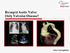 Bicuspid Aortic Valve: Only Valvular Disease? Artur Evangelista