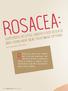 Rosacea: Rosacea is an elusive skin condition. Sufferers of Little Understood Disease May Soon Have New Treatment Options