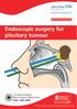 Endoscopic surgery for pituitary tumour