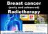 Breast cancer. (early and advanced) Radiotherapy
