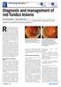 Red fundus lesions are a