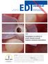 EDI Journal. Techniques to control or avoid cement around implant-retained restorations. European Journal for Dental Implantologists TOPIC