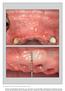 The International Journal of Periodontics & Restorative Dentistry
