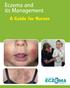 Eczema and its Management. A Guide for Nurses