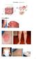 1 Eczema (Shi Zhen, 湿疹 ) Eczema/ 湿疹 pic