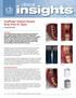 insights clinical AnyRidge Implant System Scan Post (C-Type)