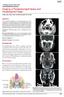 Imaging of Parapharyngeal Space and Infratemporal Fossa