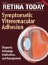RETINA TODAY Symptomatic Vitreomacular Adhesion