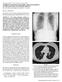 RADIOLOGY FOR PRACTITIONERS CURRENT CONCEPTS IN IMAGING AND MANAGEMENT OF THE SOLITARY PULMONARY NODULE