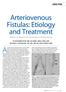 An arteriovenous fistula (AVF) is an anomalous