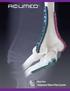 Mayo Clinic Congruent Elbow Plate System