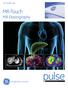 GE Healthcare. MR-Touch MR Elastography. pulse. imagination at work APPLICATION MONOGRAPH