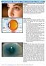 Eye Diseases: Recognize These Common Eye Conditions