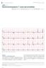 Electrocardiographic T wave abnormalities