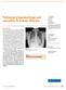 Pulmonary haemorrhage and vasculitis in Graves disease
