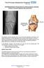 GG10Rehabilitation Programme for Arthroscopically Assisted Anterior Cruciate Ligament Reconstruction