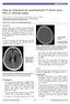 How to interpret an unenhanced CT brain scan. Part 2: Clinical cases